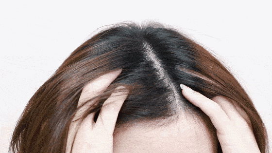 索芙特|原来发际线后移还能这样遮!我终于可以拥有“海藻头”啦