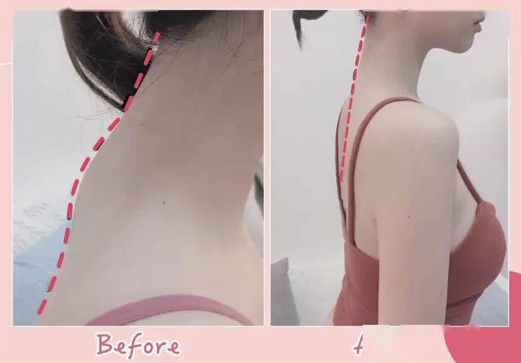 智商|张雨绮的矫姿带到底是智商税，还是真女神制造机？