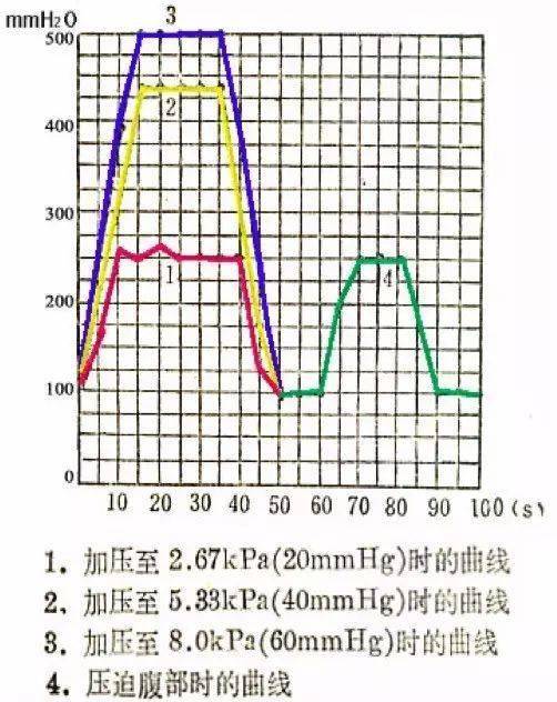 试验|腰穿测压一定要下肢伸直?腰穿检查 6 问 6 答
