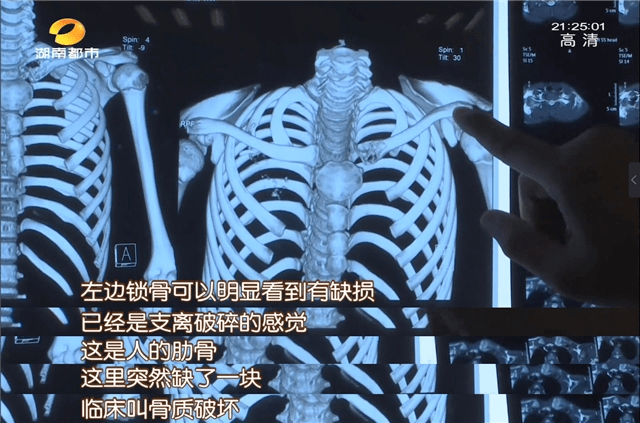 12岁|癌症晚期!妈妈崩溃说出几个细节,很多家长都没当回事……12岁儿子