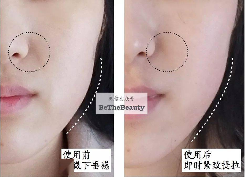 美容|以色列美容仪太牛！千万红人都用它提拉、导入、清洁，还有18K真金护理头