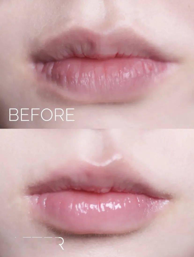 嘴唇|测评｜为啥男友不想吻我？因为我忘了涂兰芝唇膜