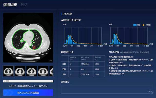 深度|行业专家核心观点分享！有关国产深度学习框架与百度飞桨