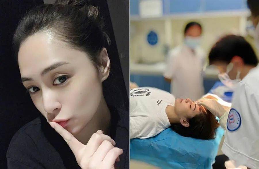 受伤|阿娇破相缝66针 太快复工被批炒作