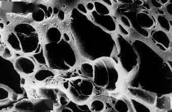 张天|长期闭口、粉刺、痘痘满脸的人，微镜头下毛孔竟然是这样的！赶紧get林允、张天爱的0毛孔秘籍吧！