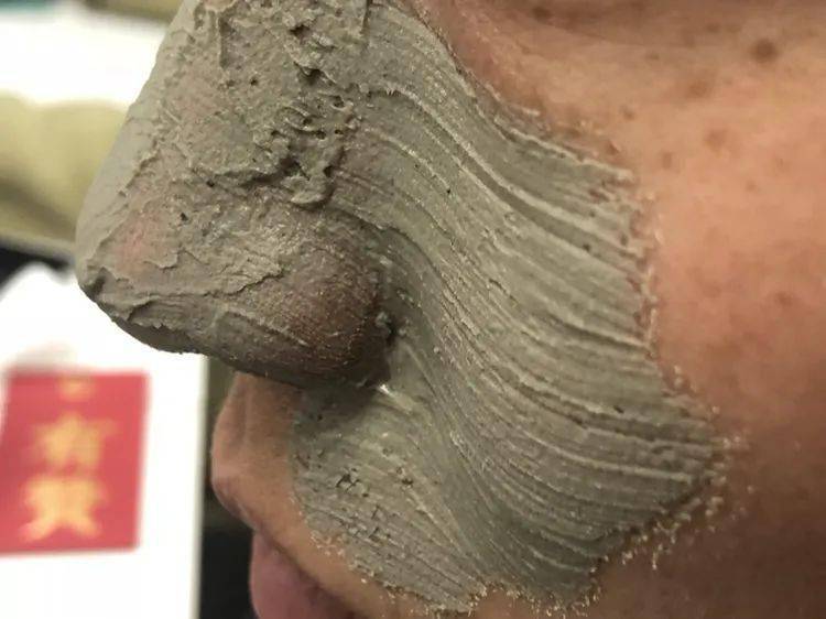 张天|长期闭口、粉刺、痘痘满脸的人，微镜头下毛孔竟然是这样的！赶紧get林允、张天爱的0毛孔秘籍吧！