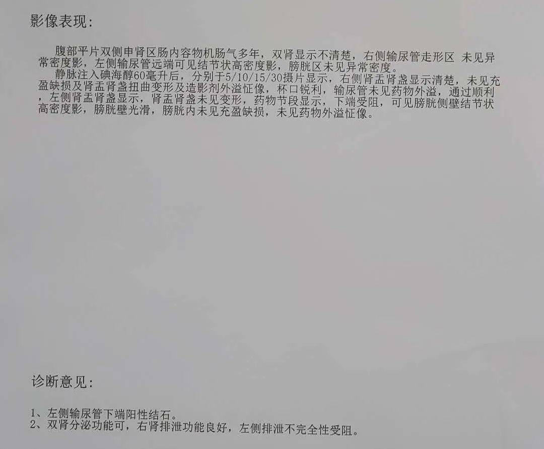 【同仁精品外科—钬激光碎石2】李晓奇主任治疗肾输尿管结石