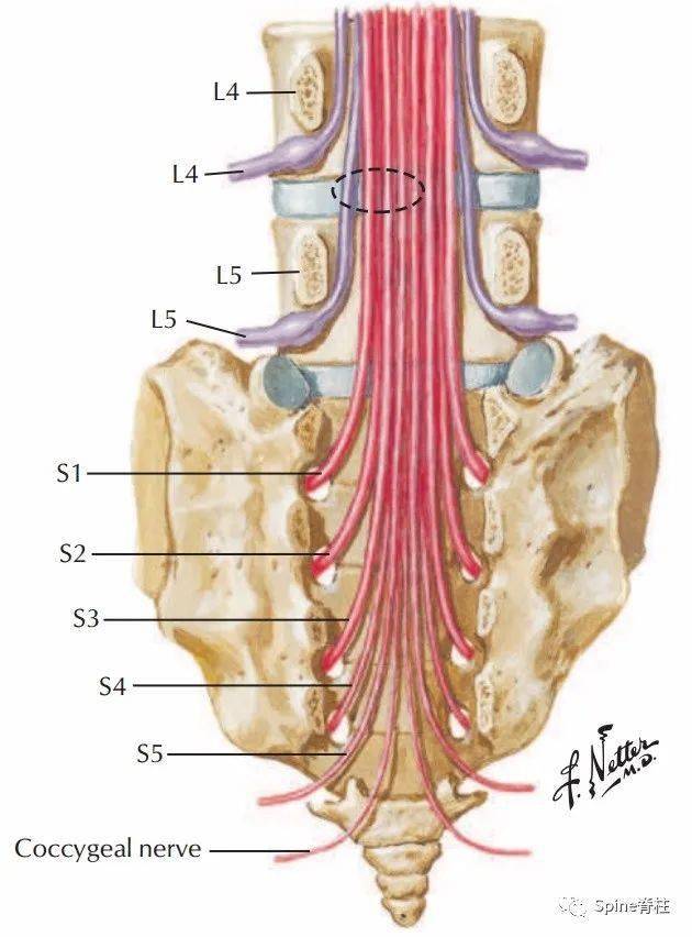 常见腰椎间盘突出与脊神经关系