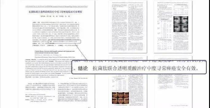 皮肤|刷酸=换脸？这个明星们超爱的百元刷酸好物搞定你的痘痘、闭口、黑头毛孔粗大还不怕烂脸！