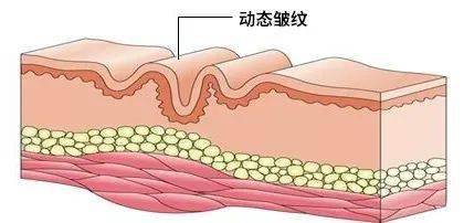 眼睛|32岁“国民老婆”喜当妈？！冻龄“眼”技完虐21岁女儿，做好这一步，真得会显年轻！