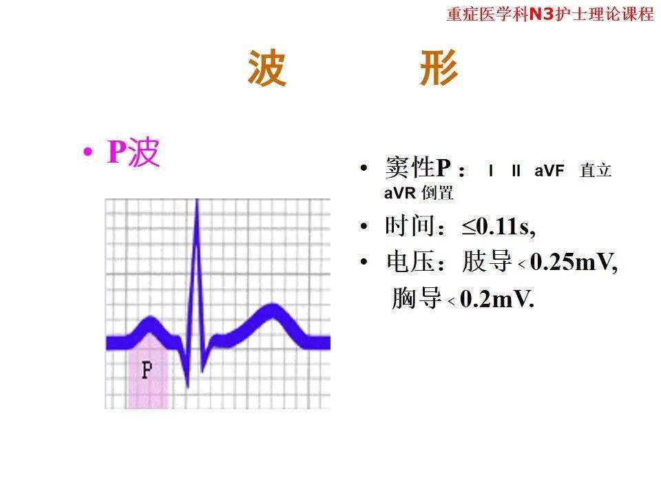 【ppt】异常心电图及常见心电图的识别及处理