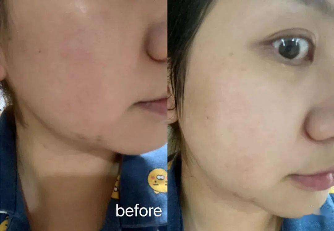 Bug|寻芳记｜换季肤况出Bug？听说比奶茶还甜的她们都用这招！