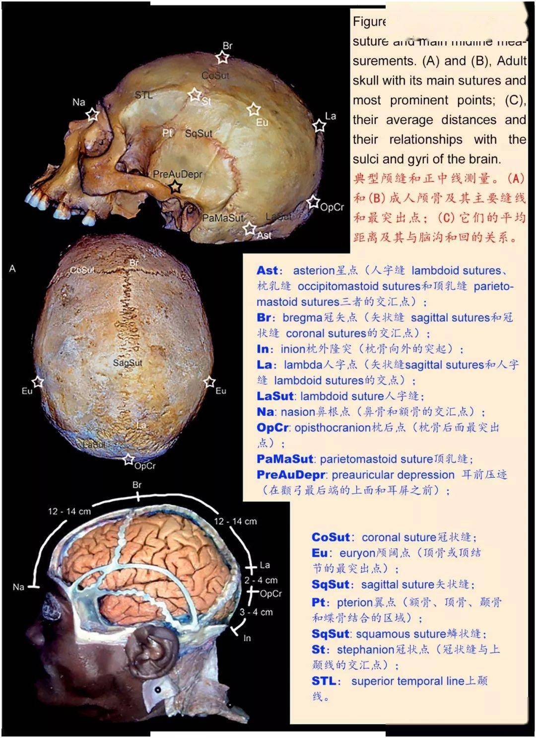 解剖详解丨一文读懂颅骨解剖美图分享