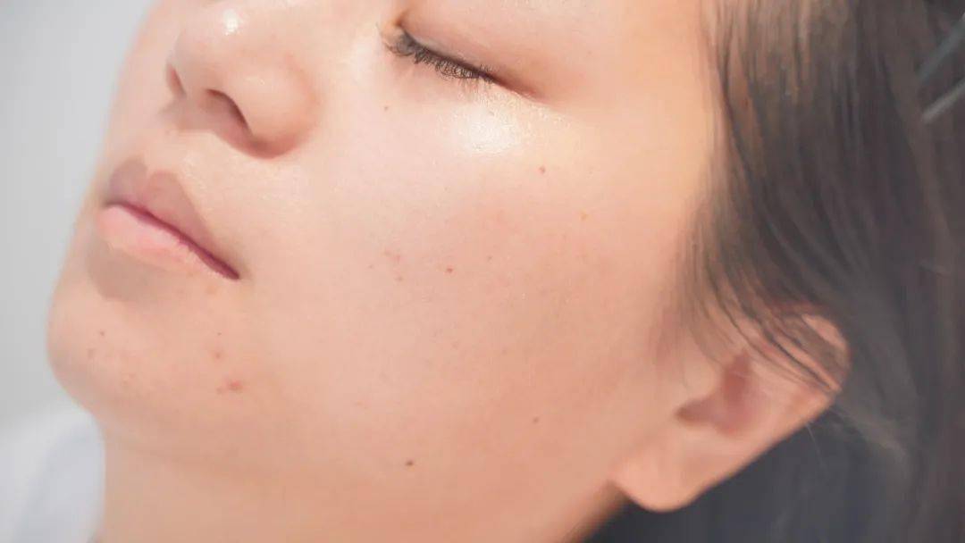 护理|价值1万1次的美容护理是什么体验？