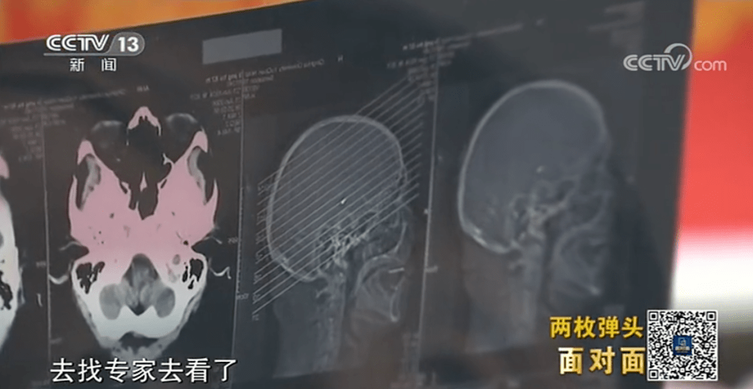 李文新|95岁抗美援朝老兵逝世，骨灰中发现两枚弹头