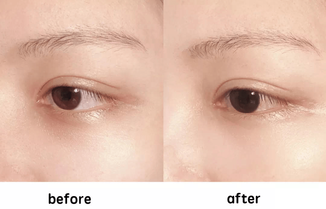 黑眼圈|430年的马应龙放大招,八宝古方做的眼霜,眼纹淡了