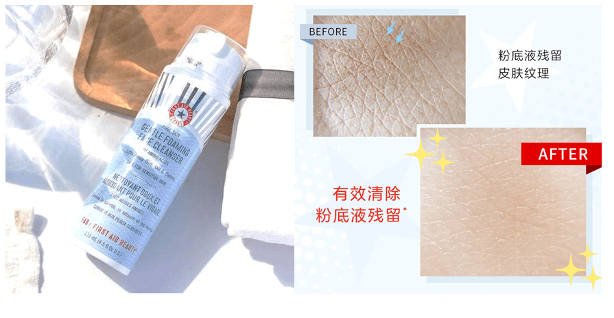 fab|种草+|女明星也空瓶的fab急救面霜,皮肤越差,效果越好!