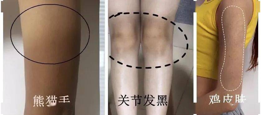 小说|长了一张「小说女主脸」是什么体验?