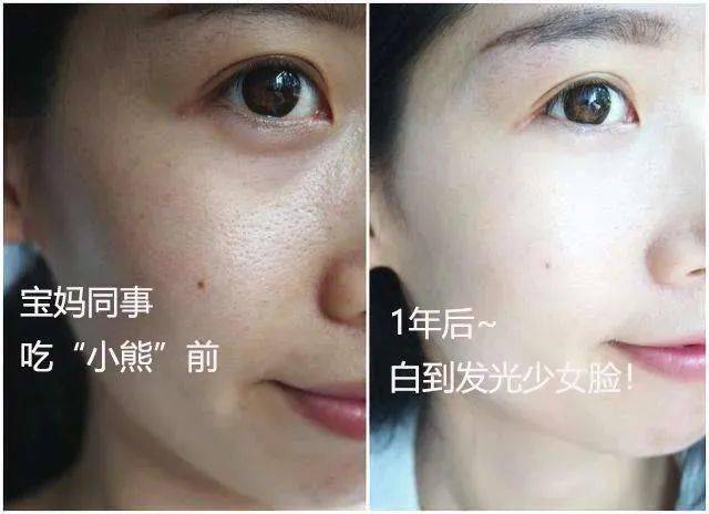 少女|春风吹人老，闲来嚼嚼它，补充胶原蛋白，50岁也能嫩回少女脸~