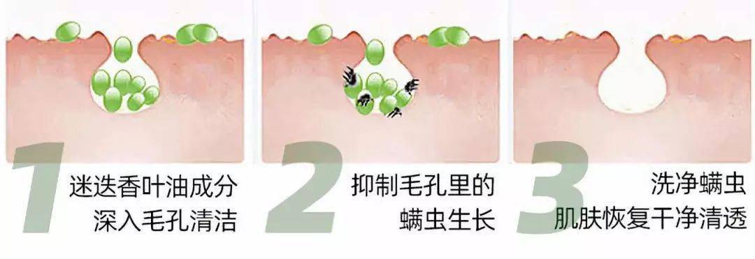 氨基酸|拒绝“螨虫脸”，5秒揉一揉，螨虫全出来了，痘痘黑头全没了！
