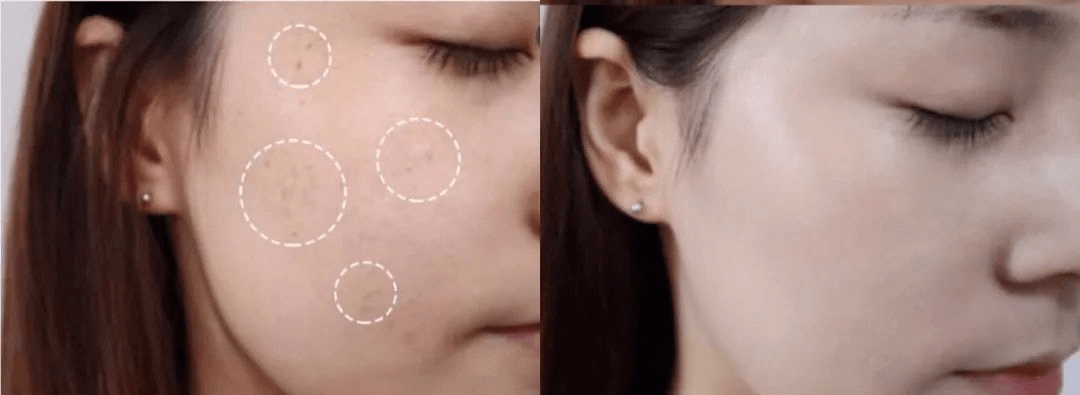 色斑|连抹7天,斑没了,皮肤真的白一度!