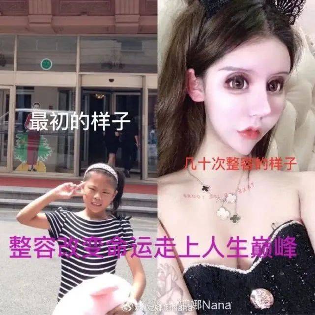 双眼皮|“我花了100万，把女儿整成了残废”：暑假整容风潮后，有20万女孩正在消失……