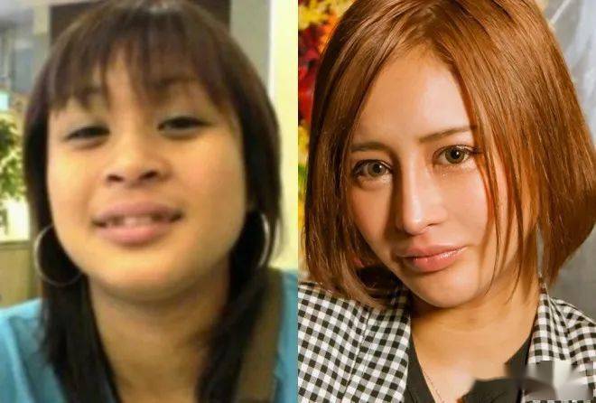 妹子|霓虹妹子整容上百次＂走上人生巅峰＂，以后还想整成桥本环奈…