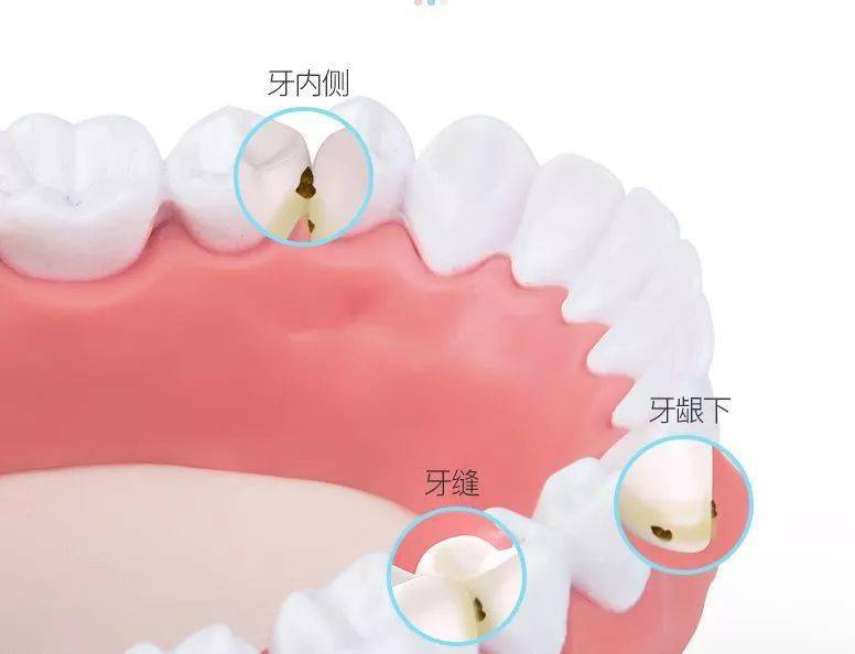 口腔|专业牙医也在用的冲牙器，1秒滋出牙缝残渣，爽！