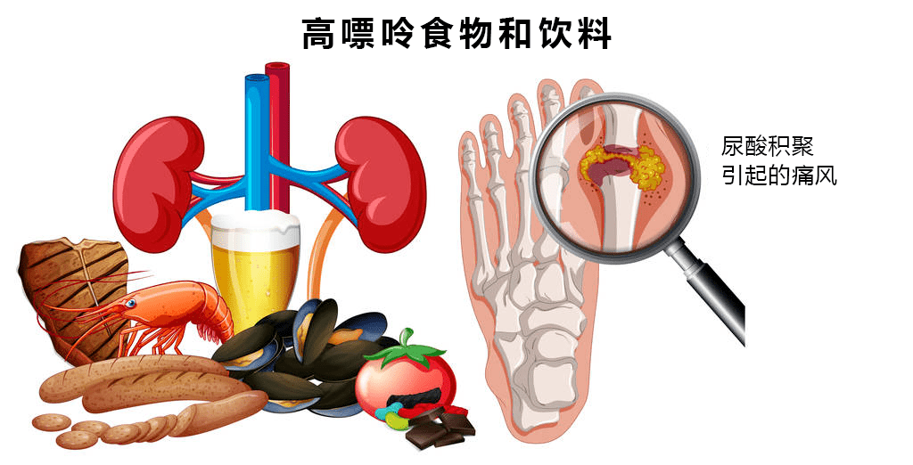 科普高尿酸这个名词