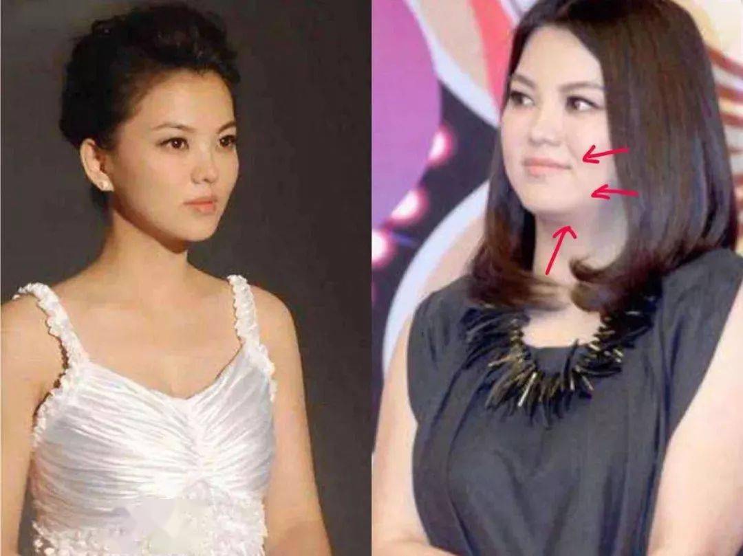 鹅蛋脸|肉脸还是大脸?选对发型你就是鹅蛋脸!