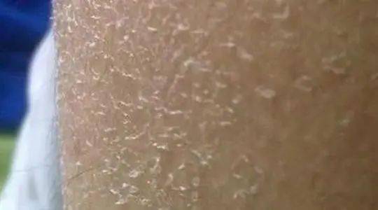 肌肤|你们会不会总想摸自己,晚上的时候......