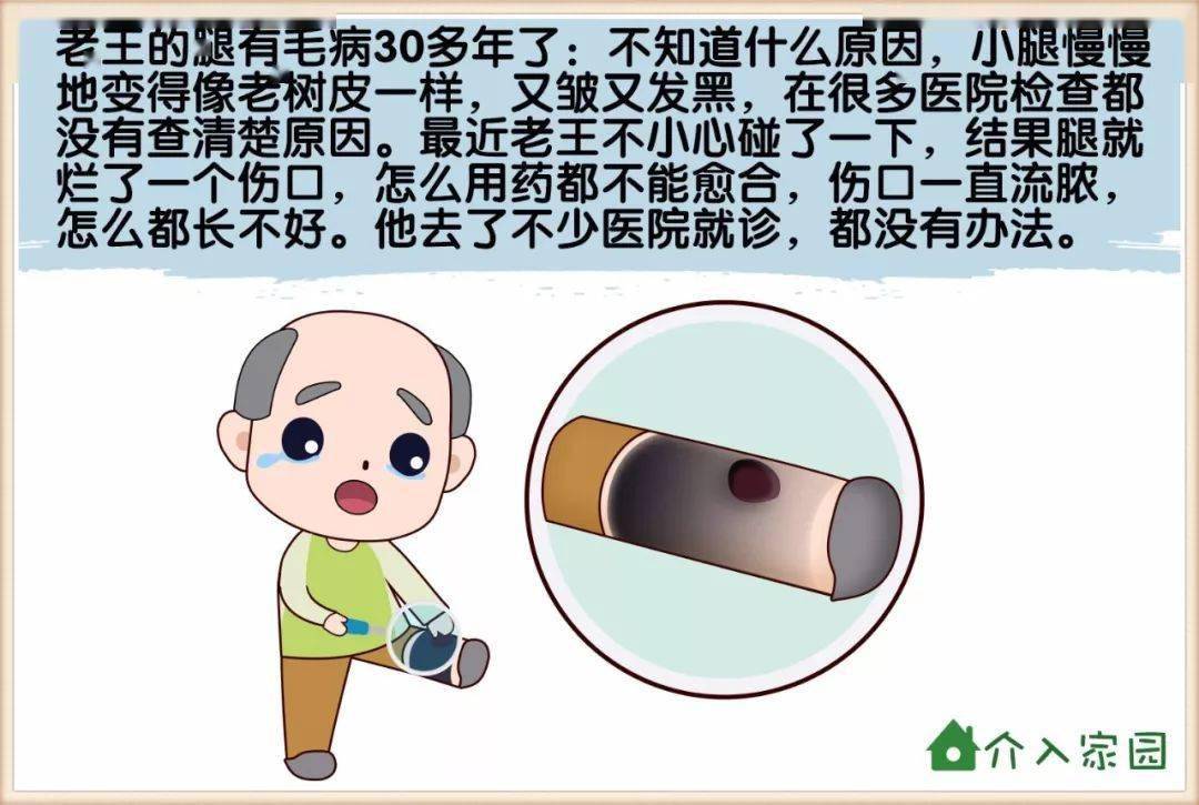 看图猜成语本是同根生相煎何太急_本是同根生相煎何太急(3)