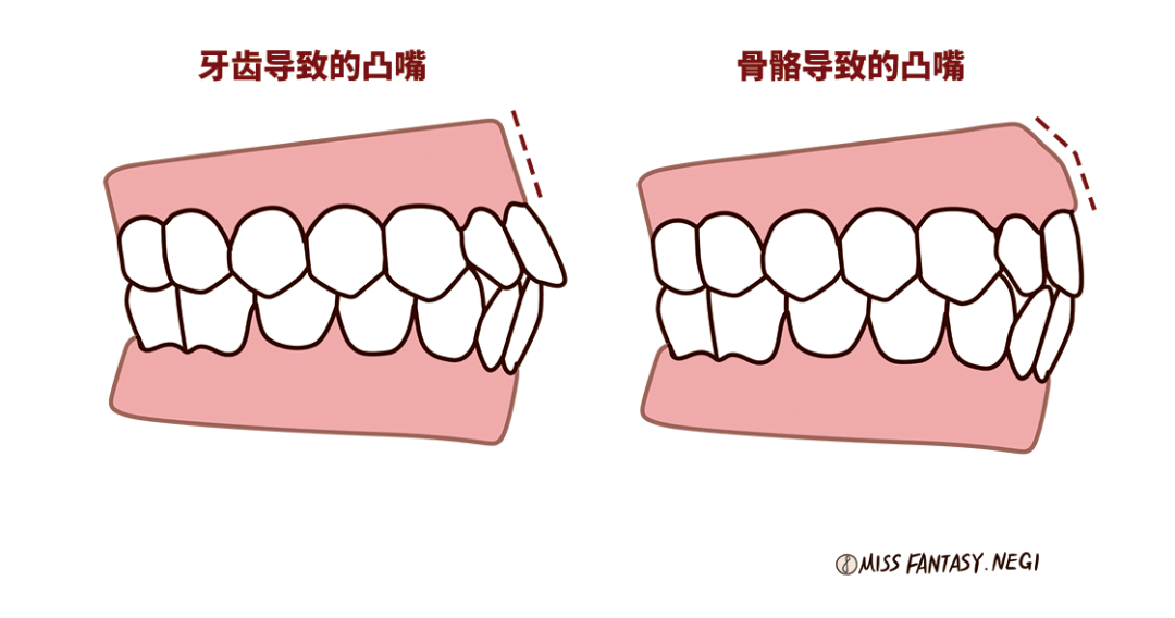 嘴唇|听说80%的人都在为这个颜值bug苦恼