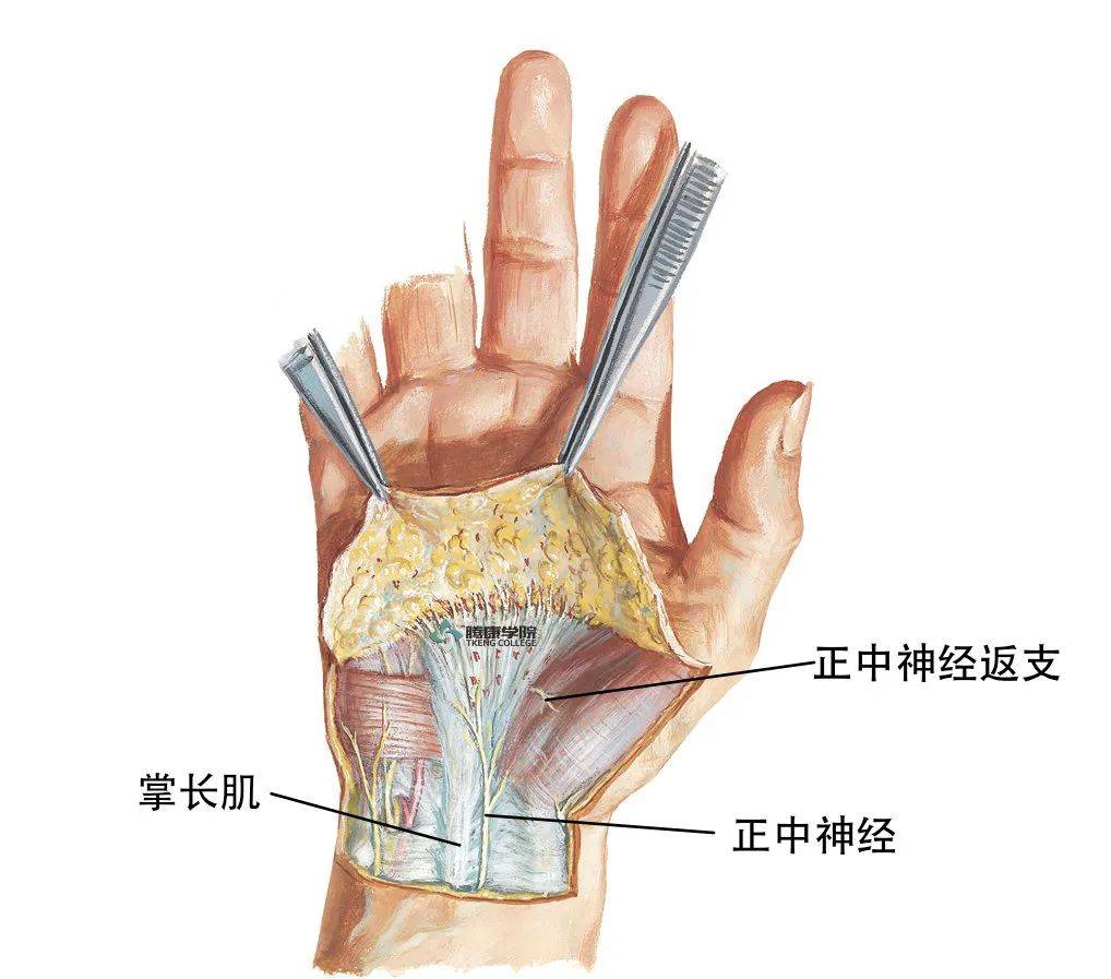 正中神经应用解剖