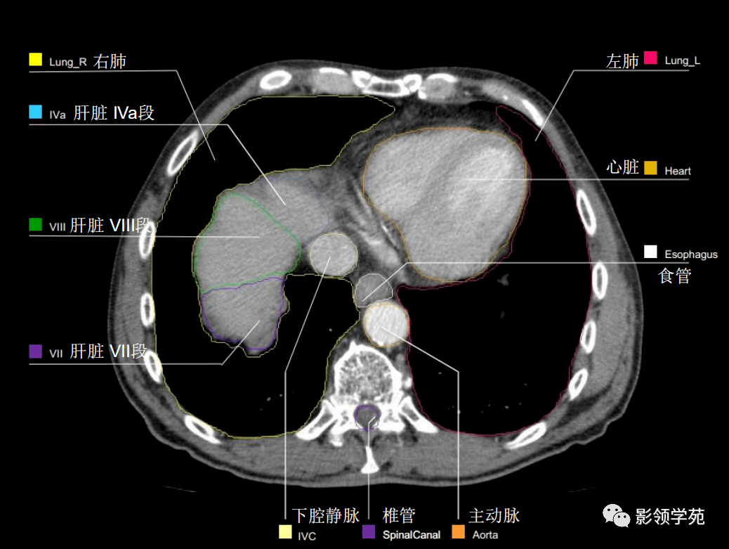 图1-4 胸腹部主要器官的体表投影(前面观)-腹部外科临床解剖学-医学