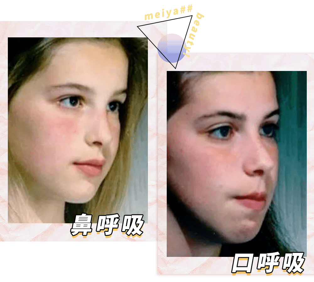 女生|为什么现在的女生，越长大越丑？