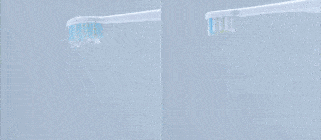 清洁|电动牙刷真的比普通牙刷好吗？我替你们问了医生