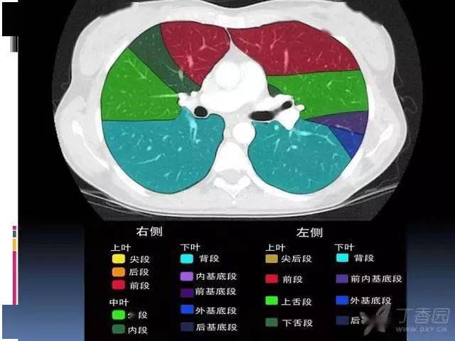 肺叶分段,支气管,肺动脉 ct 图谱全在这--值得收藏