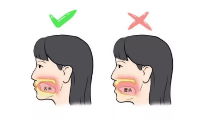 可能很多的家长都不知道:张口呼吸也是病!