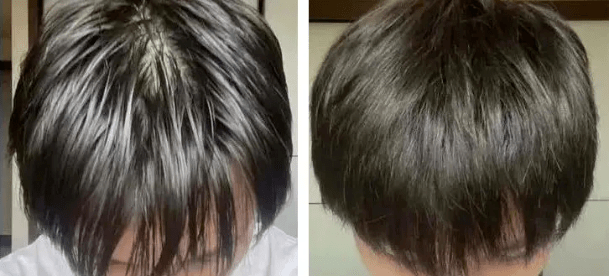 头发|洗了20几年的头，到底该洗“头皮”还是“头发”？