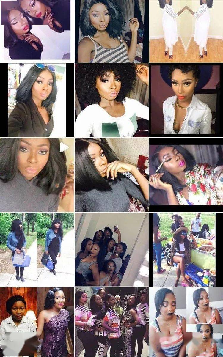 女童|非洲部落9岁毁容女童接受“换头术”，15年后现状曝光看哭网友：这才是顶级美人！