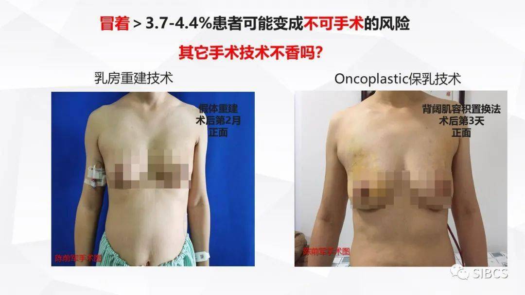 最可怕的三阴性乳腺癌 b7a601a93bb64a6cae1650bea72332d9.jpeg