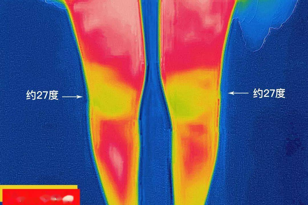 护膝|拒做老寒腿！穿上10分狂升10度，腿部小太阳，穿上秒隐形