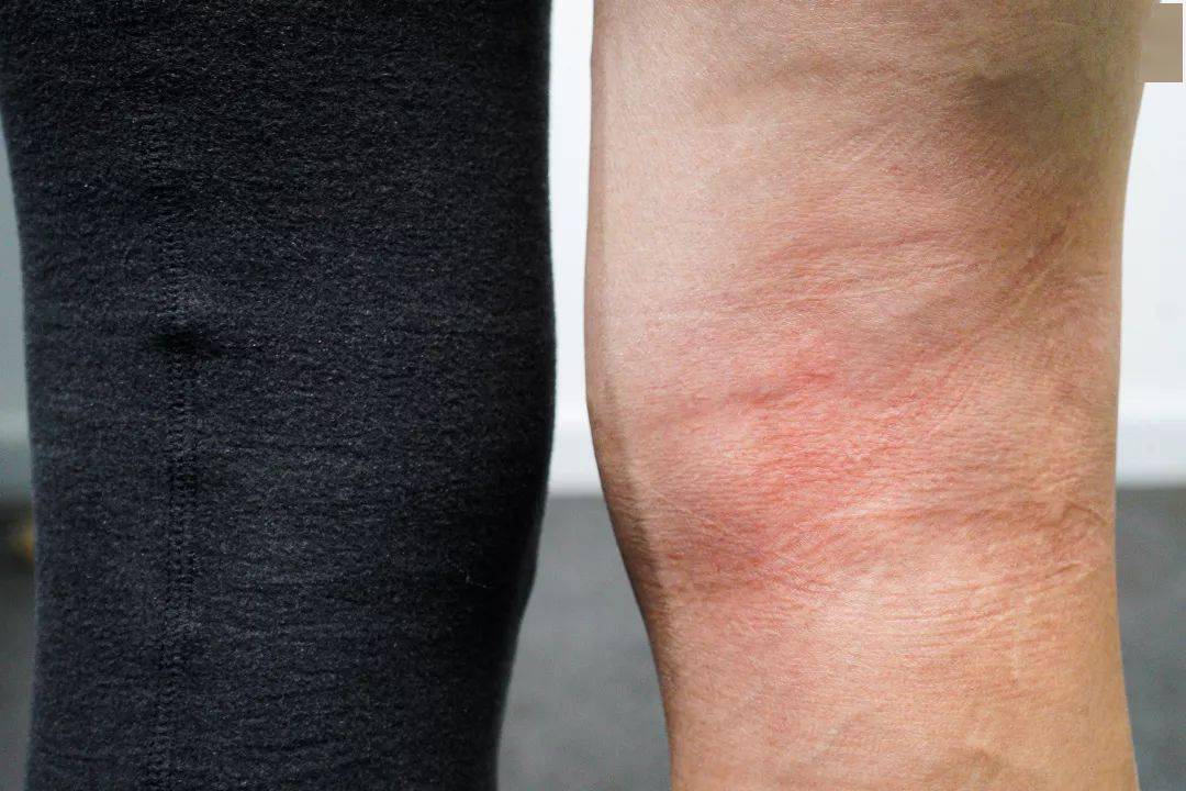 护膝|拒做老寒腿！穿上10分狂升10度，腿部小太阳，穿上秒隐形