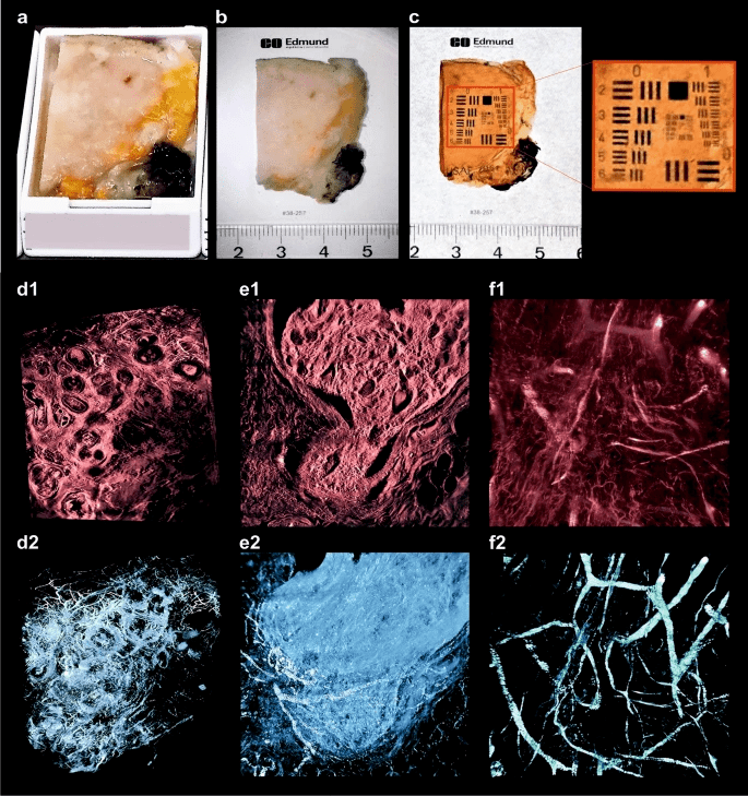 组织|【新技术】3D肿瘤显微镜可对肿瘤组织进行三维角度分析，简化肿瘤诊断！价格便宜易操作！