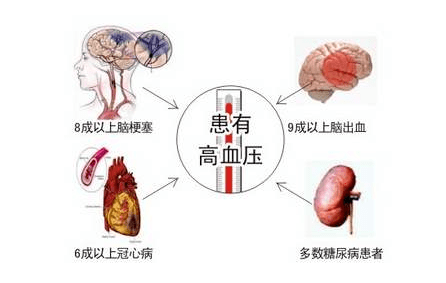 中国高血压防治指南_手机搜狐网