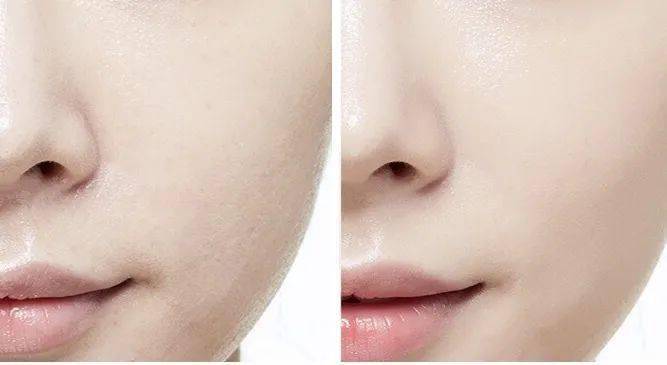 预售|200块也能化出百万化妆师同款底妆！3分钟让毛孔隐形，get粉嘟嘟的奶油肌！实在是太好看了~