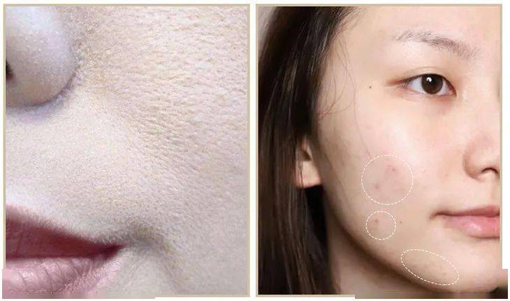 皮肤|毛戈平又放大招，“重返”20岁原来这么简单？