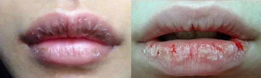 唇膏|干唇星人唇膏，轻松摆脱干燥开裂的“沙漠唇”！