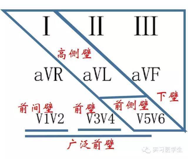 心电图零基础到有序阅读
